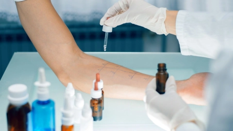 Ein Arzt träufelt mit einer Pipette Flüssigkeit auf den Unterarm eines Mannes. Auf dem Arm sind Linien und Testfelder aufgezeichnet.