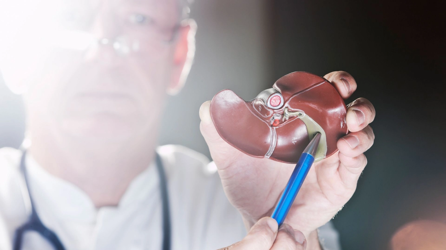 سرطان المرارة وسرطان القنوات الصفراوية: طبيب يحمل في يده اليسرى نموذجًا للكبد مع المرارة. ويمسك بيده اليمنى قلمًا يشير به إلى المرارة.