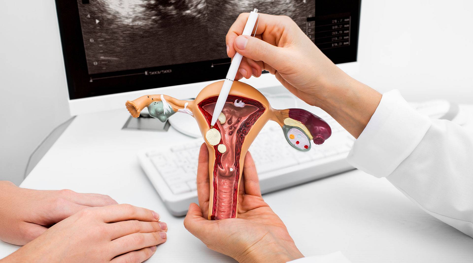 Gebärmutterpolypen Anzeichen und Therapie gesund.bund.de