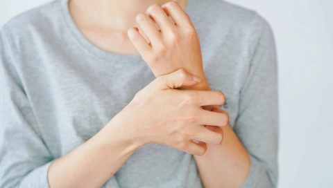 Eine Frau kratzt sich am Arm.