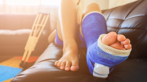 Person mit eingegipstem Fuß und Unterschenkel.