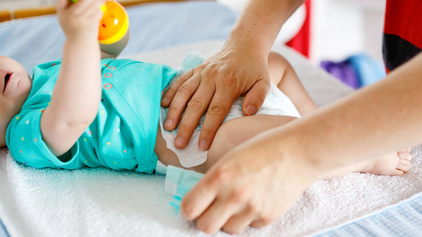 Einem Baby wird eine Windel angelegt.